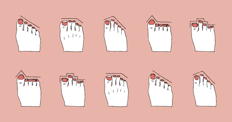 tipologia di piede